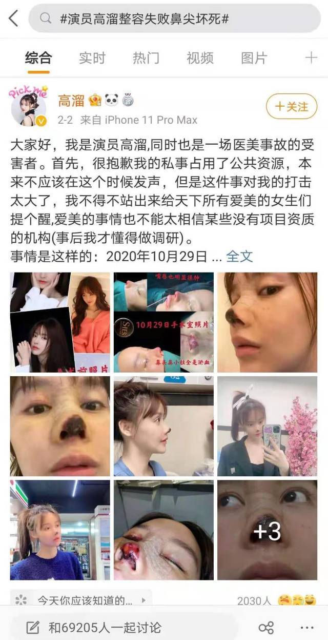 医美鼻子整形失败 高溜 熙施时光医疗美容门诊_整容失败的女明星中国